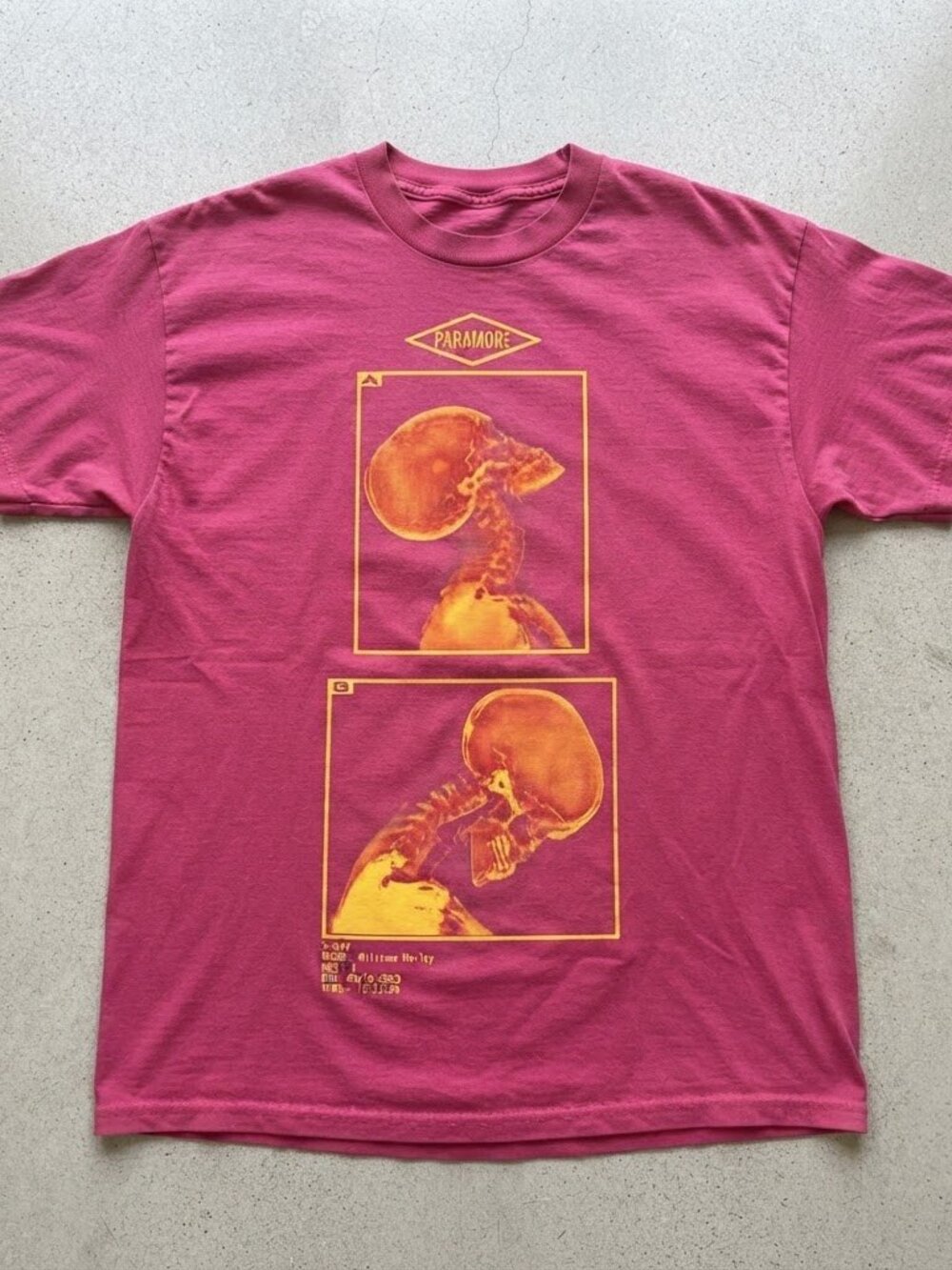 Paramore X-Ray Skull Pink Graphic T-Shirt Unisex S-4XL